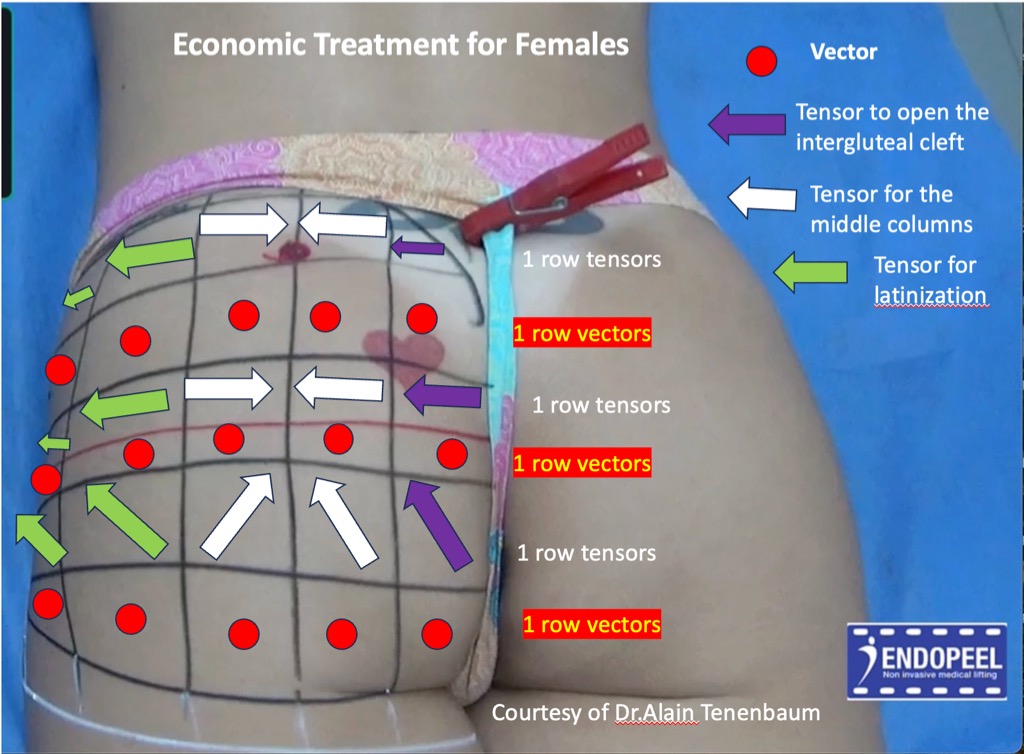 economic-treatment-for-females