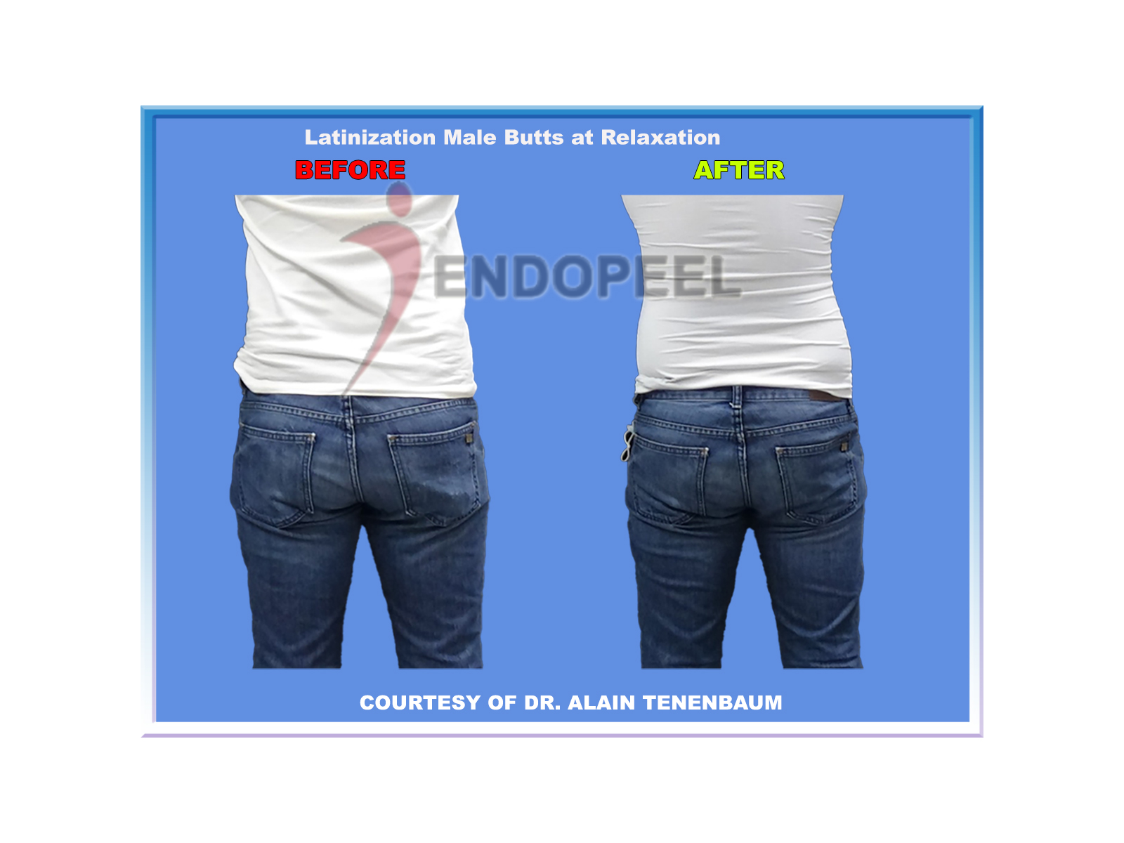  Latinization of  Male Butts at Relaxation