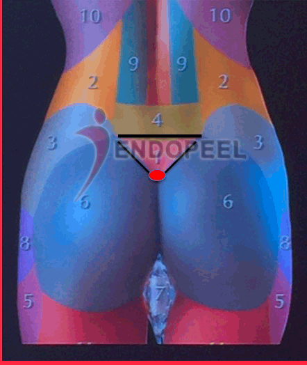 widening movement of intergluteal cleft
