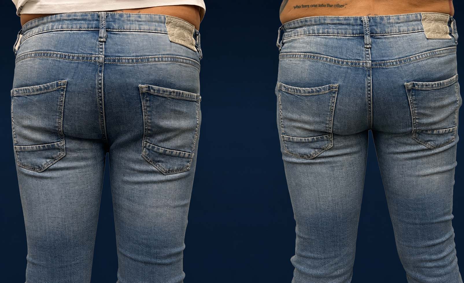Male gluteal implant contour before and after myomodulation