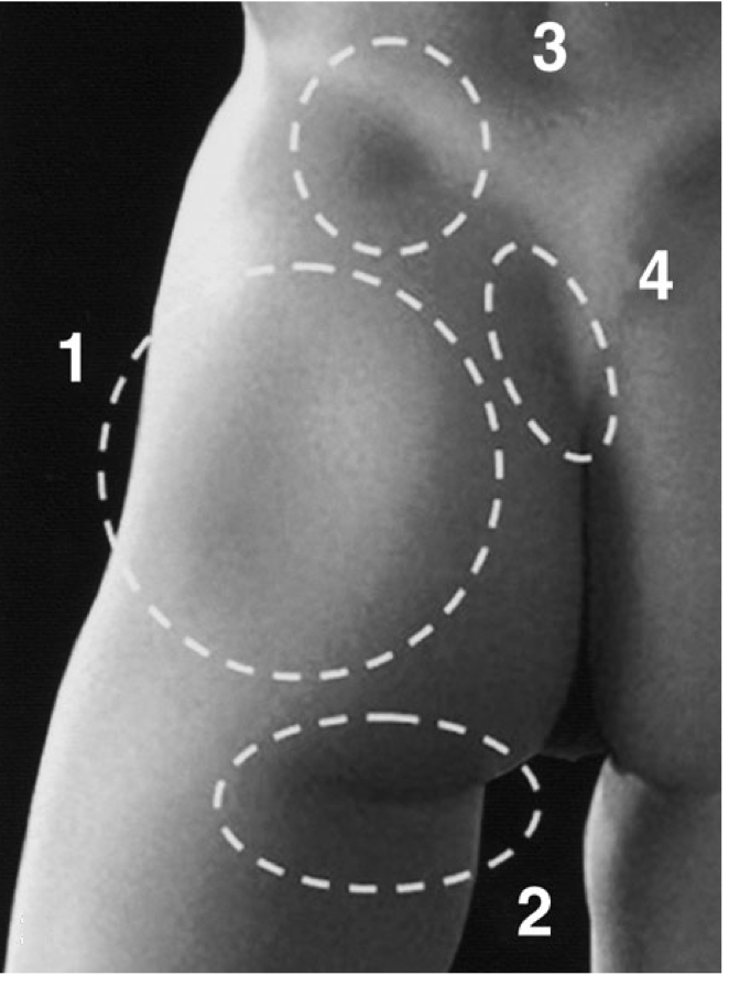 photographic features of white female butts 