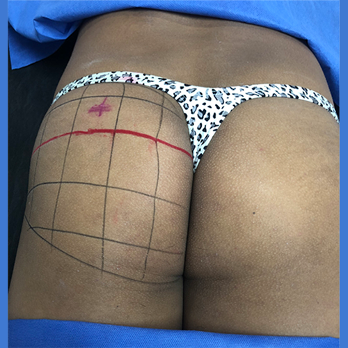 max projection point over red line