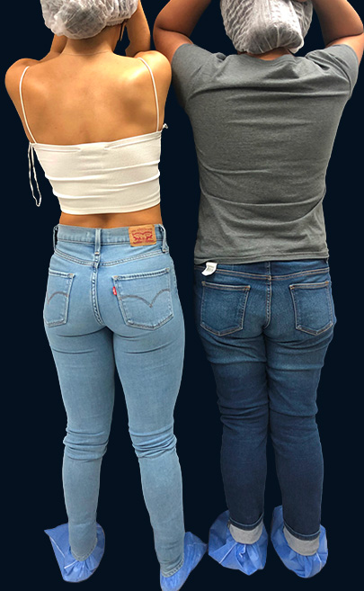 Female and male gluteal contours influenced by anatomy and jeans style