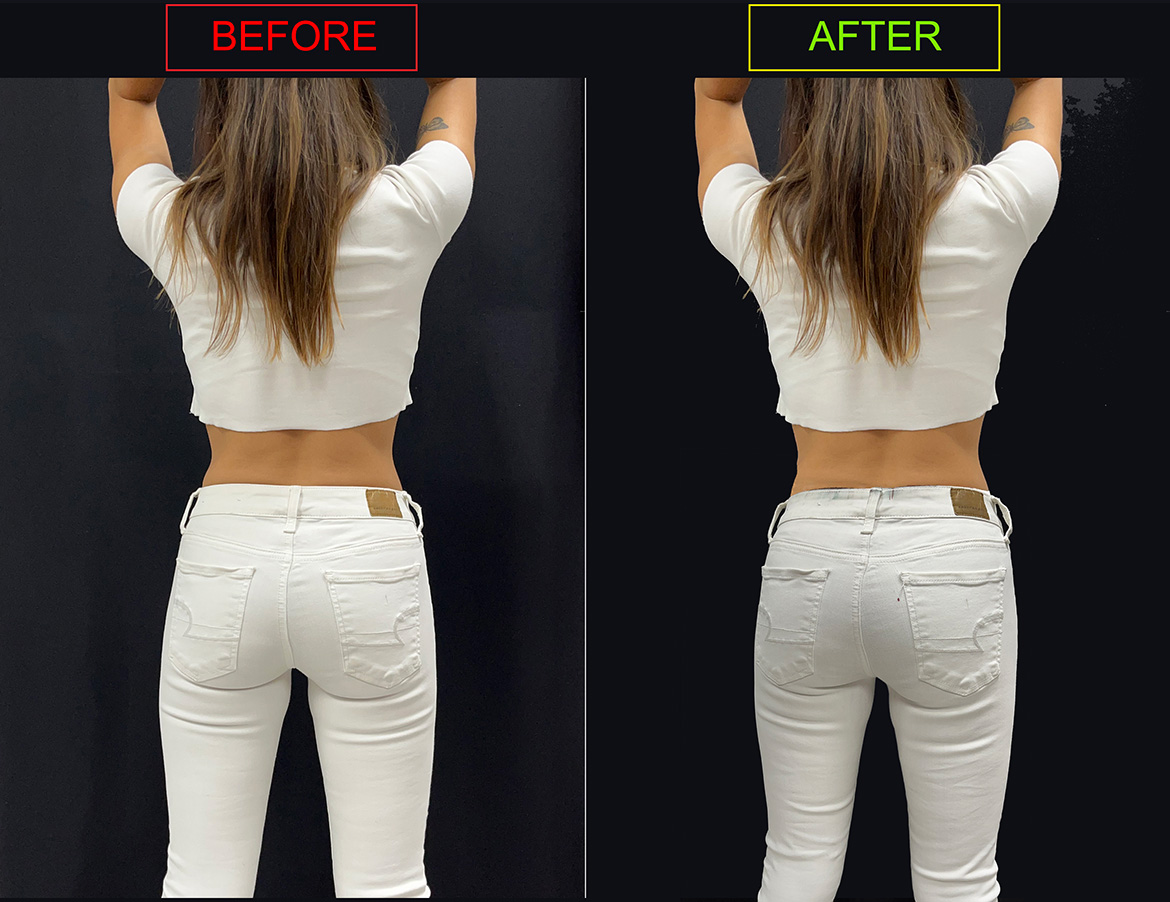 Results female butt new trends with white jeans