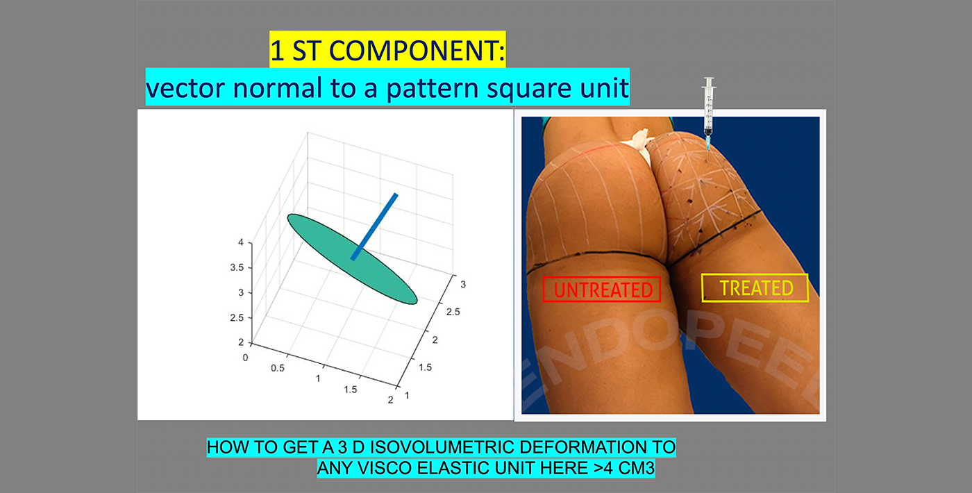 vector-gluteoplasty