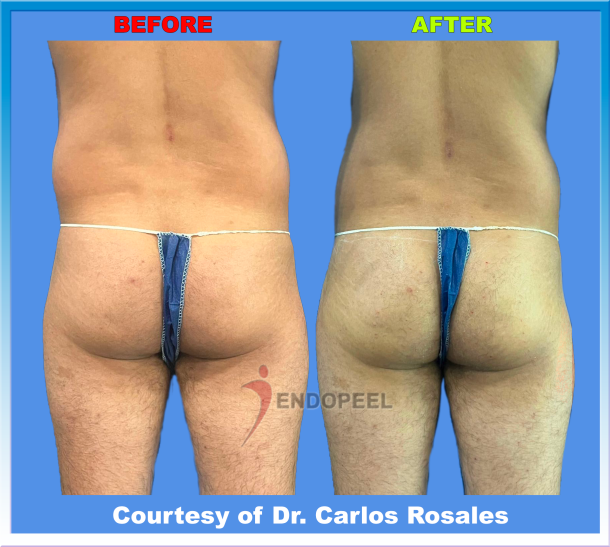 mature-man-falling-butt-back1