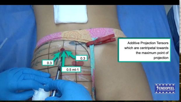 additive-projection-tensors