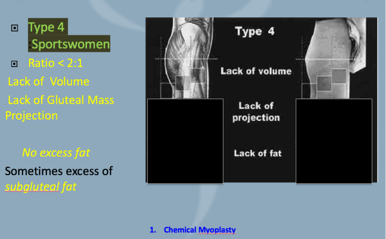 type 4 white female butts