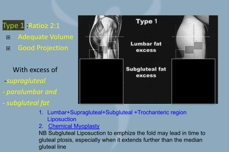 type 1 female white butts