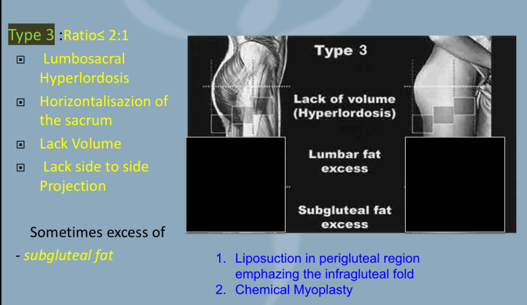 type 3 white female butts