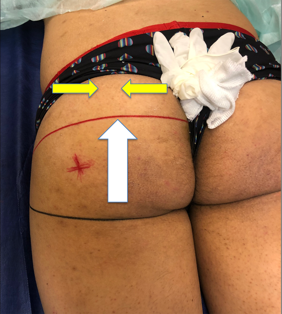 red line is so important