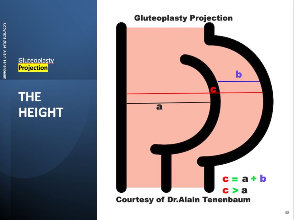 height-projection